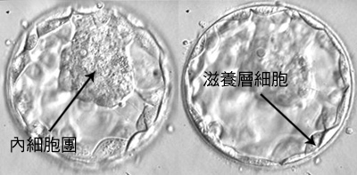 囊胚移植