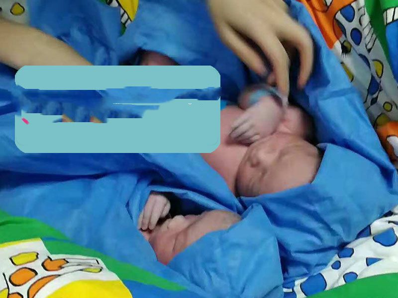 医院诊断死精症,成功广州助孕双胞胎男宝宝